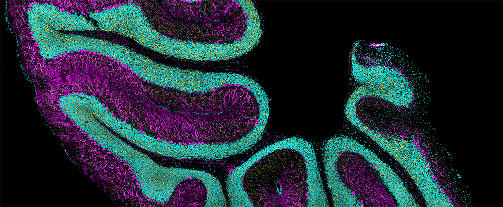 Cesar_Intro with Three Image CTA Component