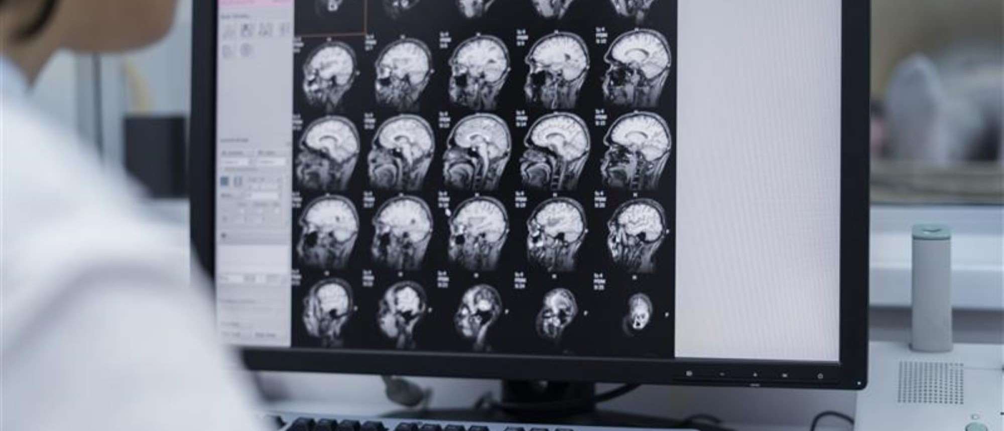 A person looking at brain scans