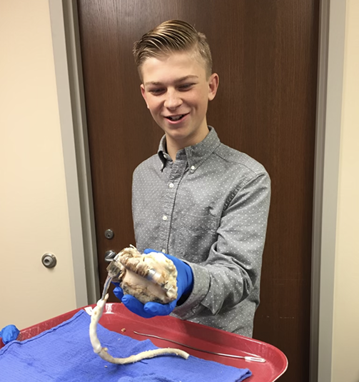 Jackson Radandt holding diseased heart