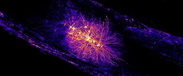 Lightsheet microscopy image of a whole, optically cleared rodent spinal cord