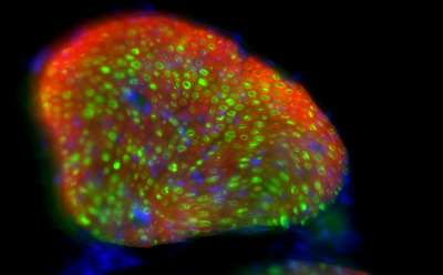 Nerve with expressions lit in green due to optogenetic imaging implemented by the NEMo Lab