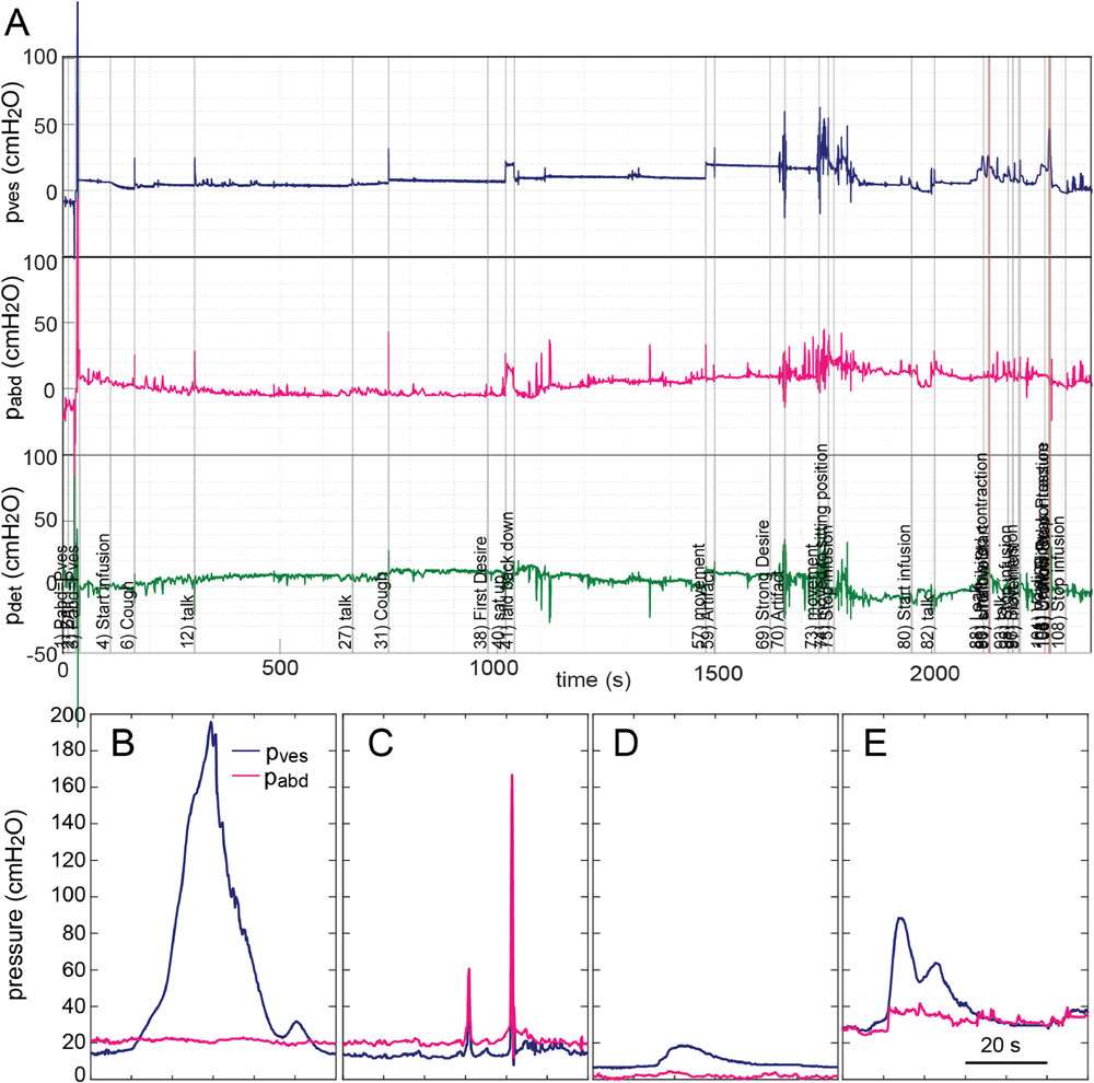 Graph illustrating data collection for predicting urinary continence status