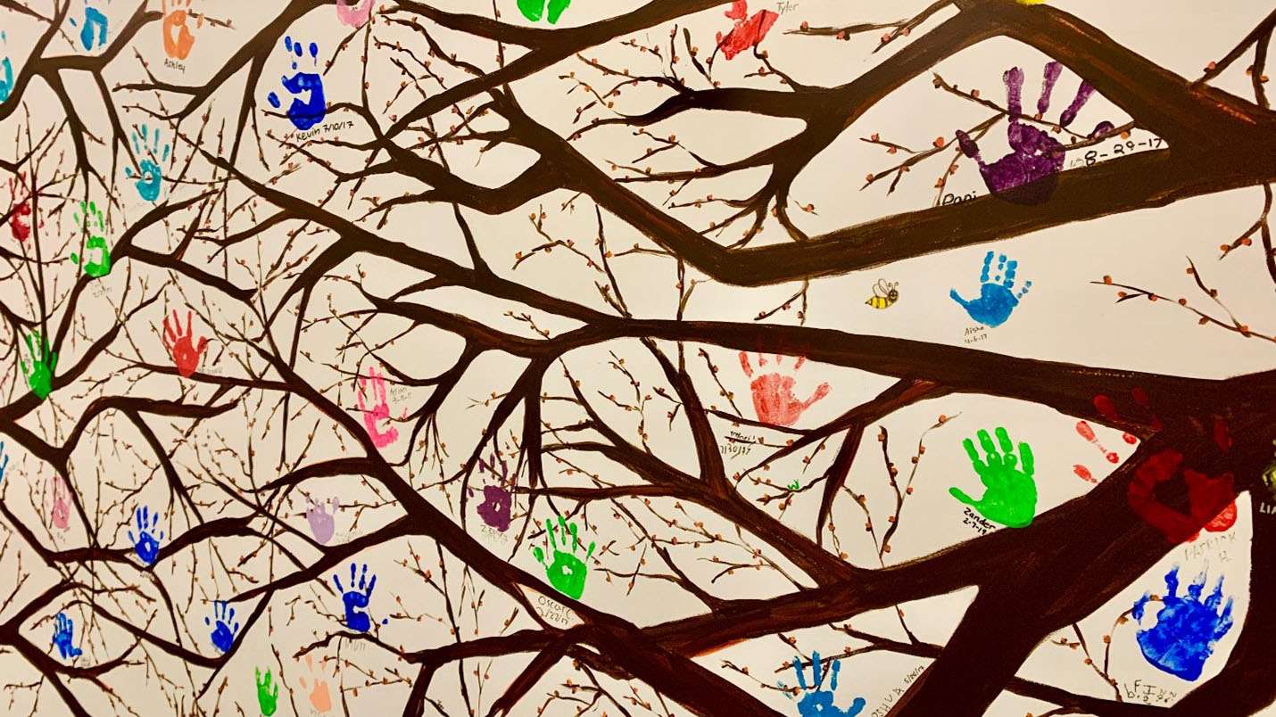 Hand Surgery Fellowship at MCW