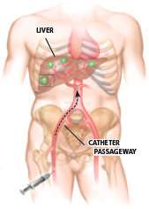 torso anatomy drawing