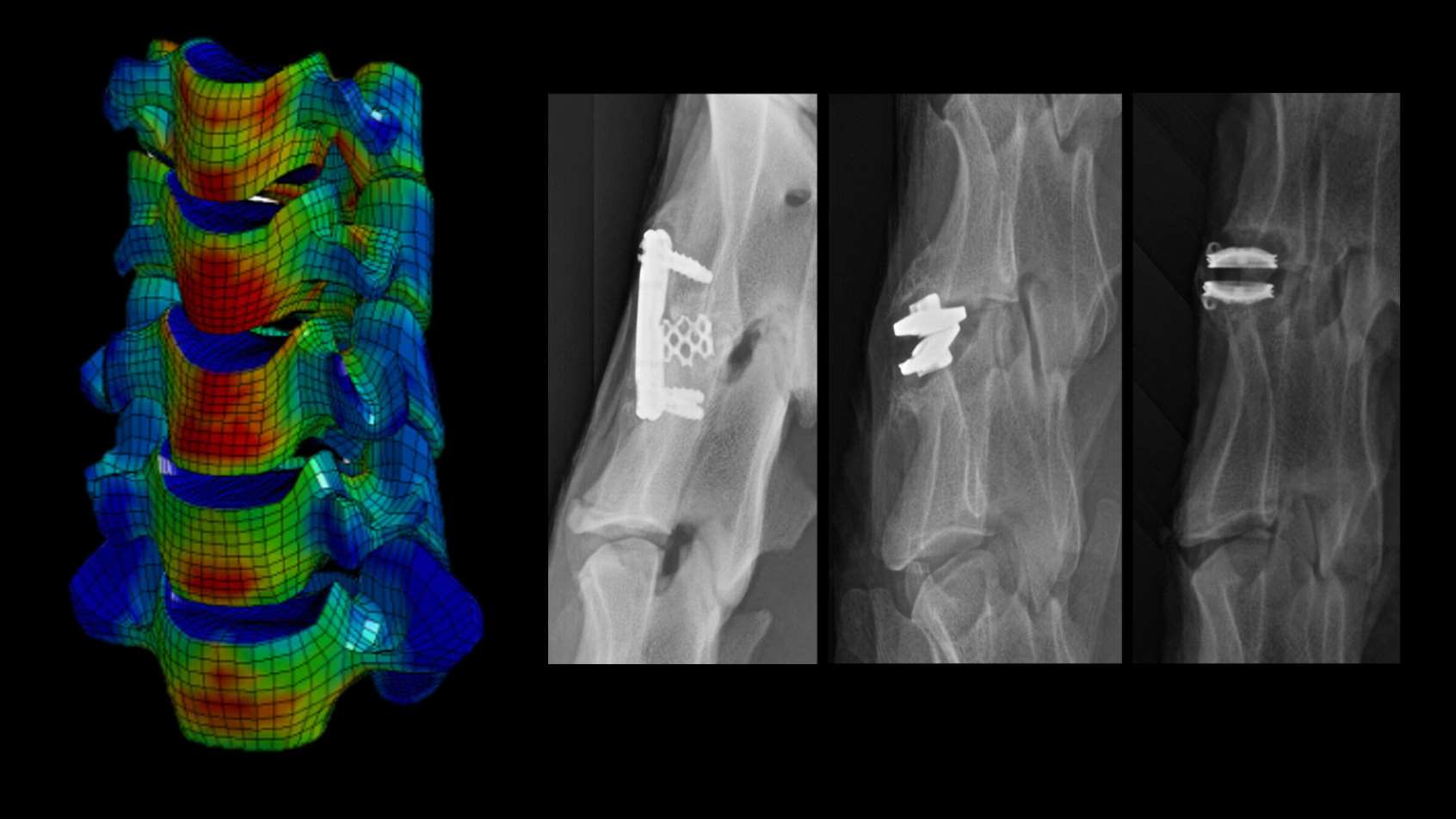 Spine Biomechanics Research | ZVAMC Labs | Medical College Of Wisconsin